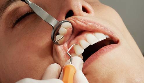 Why Dental Care Is An Important Part Of Our Life Why Dental Care Is An Important Part Of Our Life