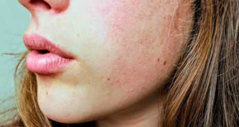 How to Boost Your Skin&rsquo;s Health and Quality